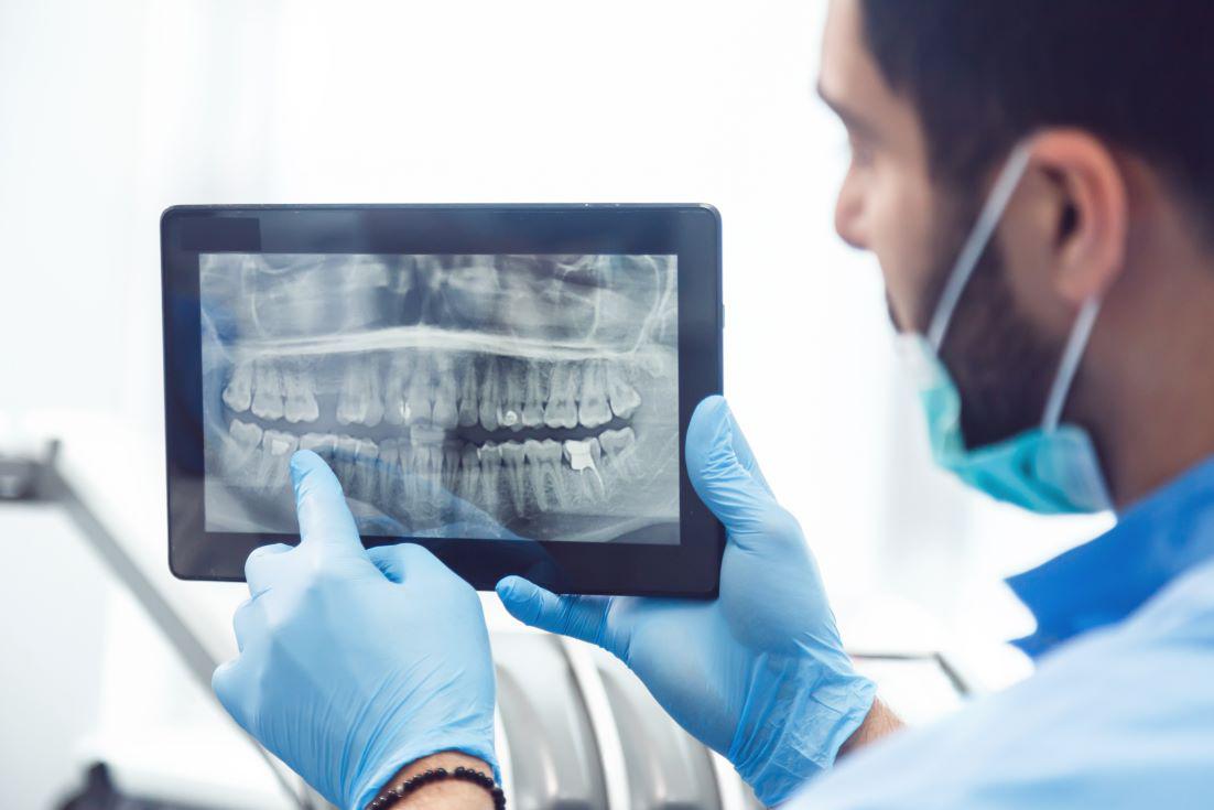 Do I Need Dental X-Rays Every Year?