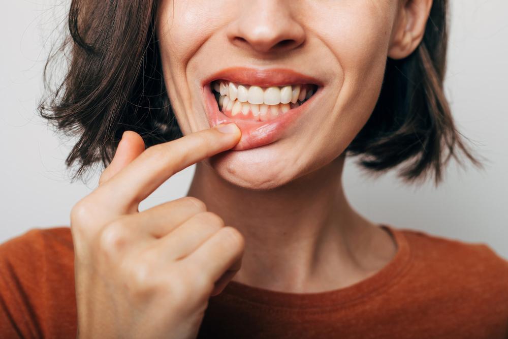 Celebrate Gum Care Month!